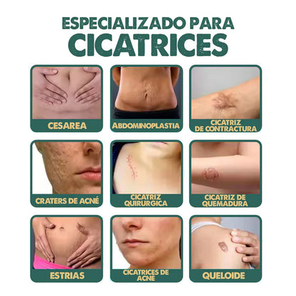 Spray para Cicatrices