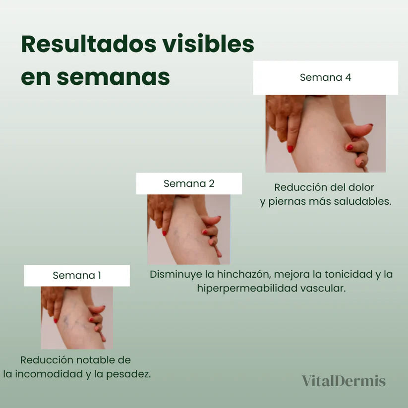 VitalVarices- Crema Para Varices y Arañitas